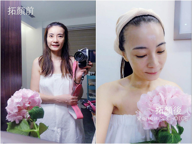 拓顏前後1