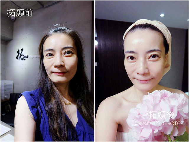 拓顏前後3