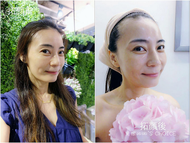 拓顏前後2