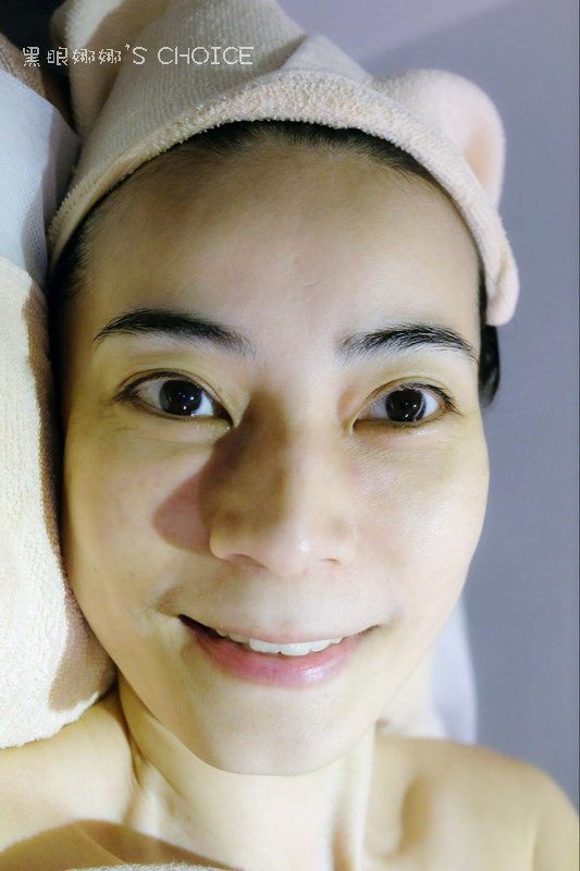 拓顏後保養完開心