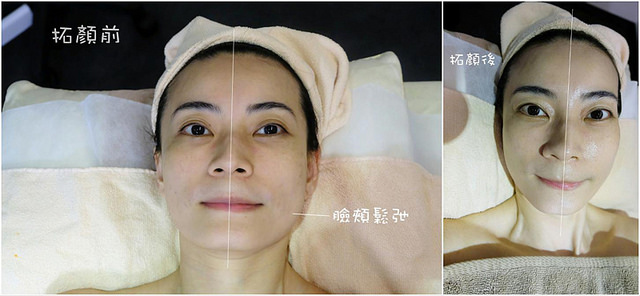 拓顏前後-s
