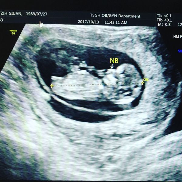 1518357381-1724888969_n.jpg?v=1518357383