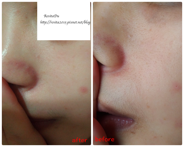 1522582640-3683794188_n.png?v=1522582854