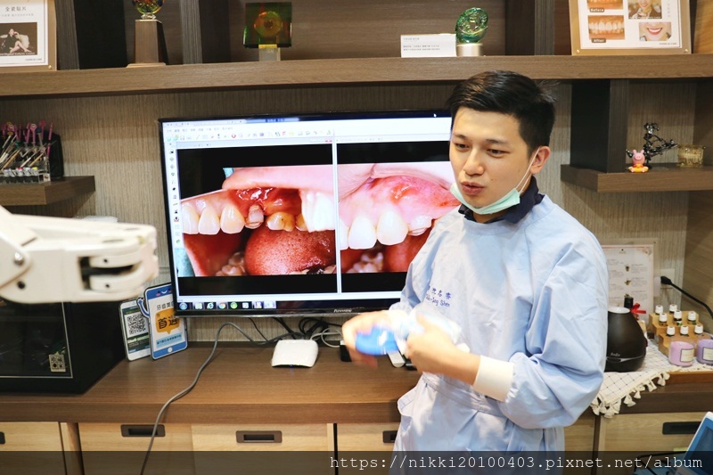20180912牙冠手術 (27).JPG