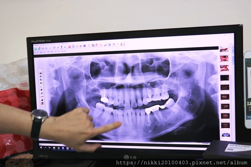 20180818診斷諮詢 (26).JPG