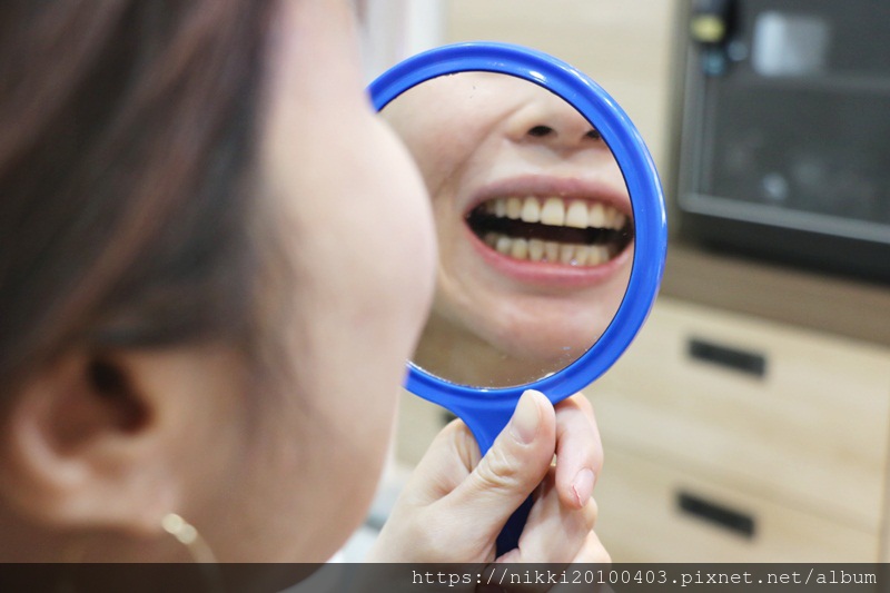 20181020瓷牙 (109).JPG