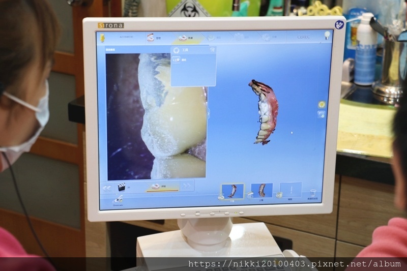 20181020瓷牙 (21).JPG