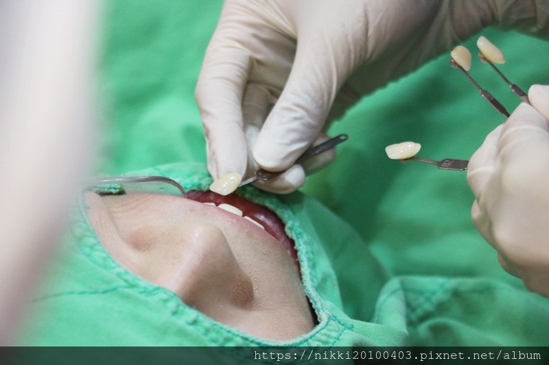 20181020瓷牙 (25).JPG