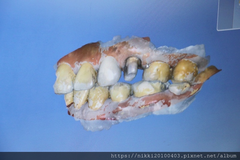 20181020瓷牙 (32).JPG