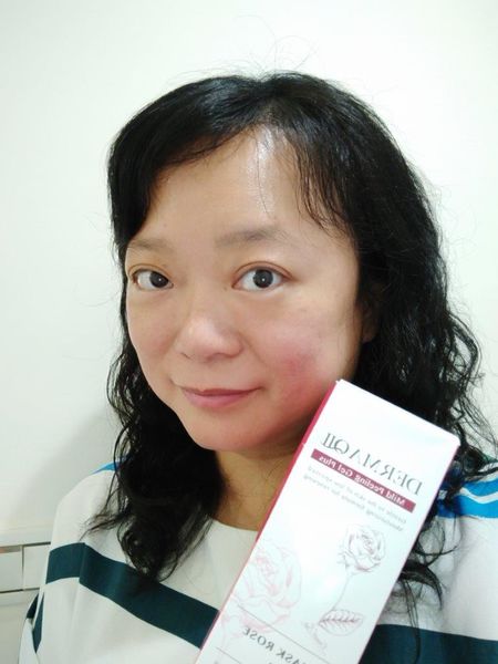 【體驗】去角質美容液臉部身體敏弱肌適用@DERMA QII8