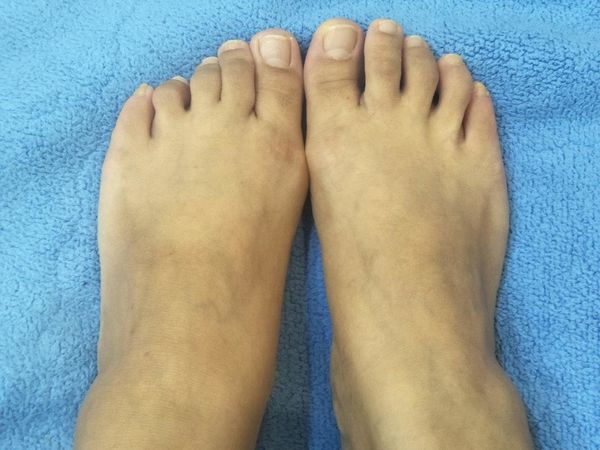 【體驗】去角質美容液臉部身體敏弱肌適用@DERMA QII10