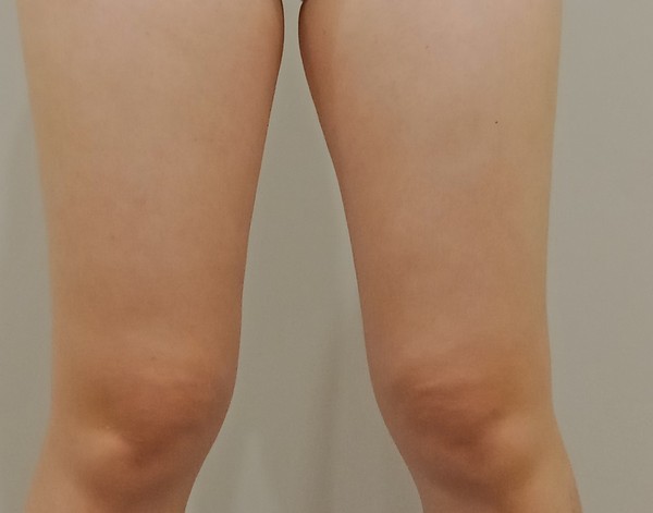 cm20180807___9dd72b4e97b7e680e02526961e1