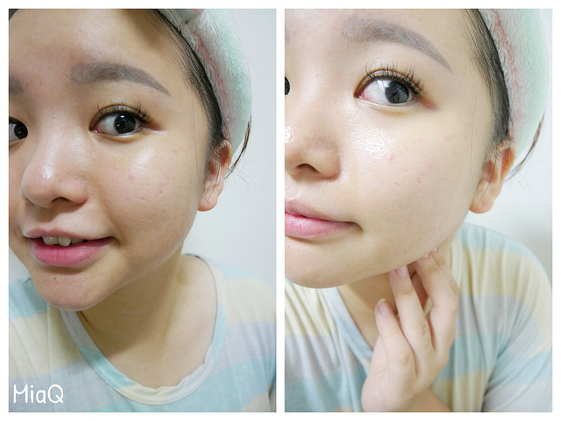 L'AURORA極光美學 (3)